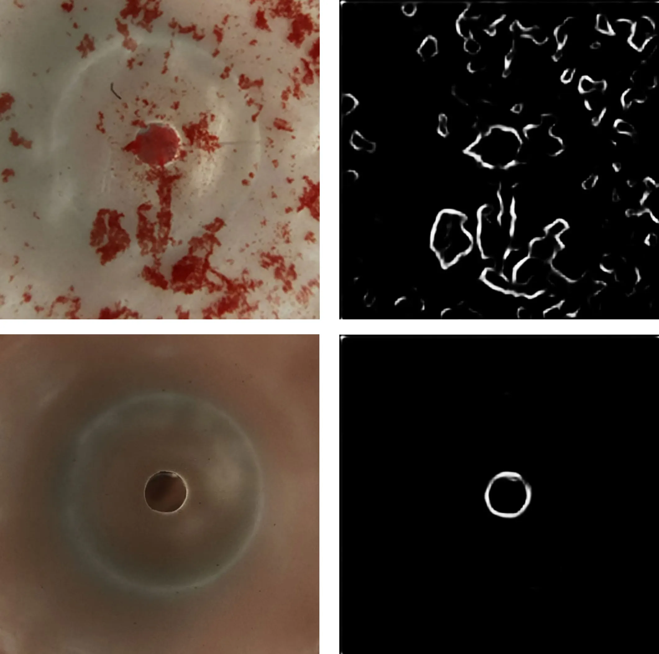 Camera views of agglutination samples on the left, with the edge detection output on the right