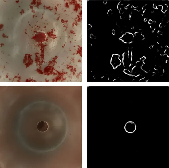 Camera views of agglutination samples on the left with the corresponding edge detection output on the right